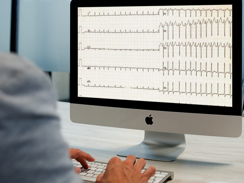 Design and Rationale of the National Tunisian Registry of Atrial Fibrillation: Protocol for a Prospective, Multicenter Trial Design and Rationale of the National Tunisian Registry of Atrial Fibrillation: Protocol for a Prospective, Multicenter Trial