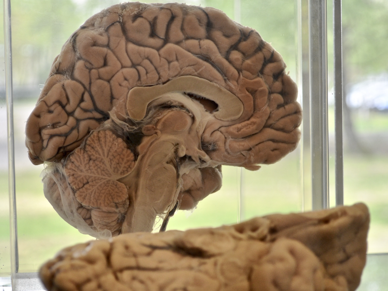 Importance and Presence of High-Quality Evidence for Clinical Decisions in Neurosurgery: International Survey of Neurosurgeons Importance and Presence of High-Quality Evidence for Clinical Decisions in Neurosurgery: International Survey of Neurosurgeons