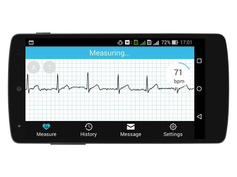 Testing MD-Link, a Low-Cost Mobile Electrocardiography Monitoring Device, in Patients With Irregular Heartbeat: Protocol for a Cross-Sectional Study Testing MD-Link, a Low-Cost Mobile Electrocardiography Monitoring Device, in Patients With Irregular Heartbeat: Protocol for a Cross-Sectional Study