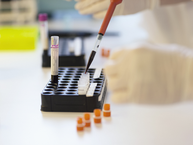 Safety of Intranasal Ketamine for Reducing Uncontrolled Cancer-Related Pain: Protocol of a Phase I/II Clinical Trial Safety of Intranasal Ketamine for Reducing Uncontrolled Cancer-Related Pain: Protocol of a Phase I/II Clinical Trial
