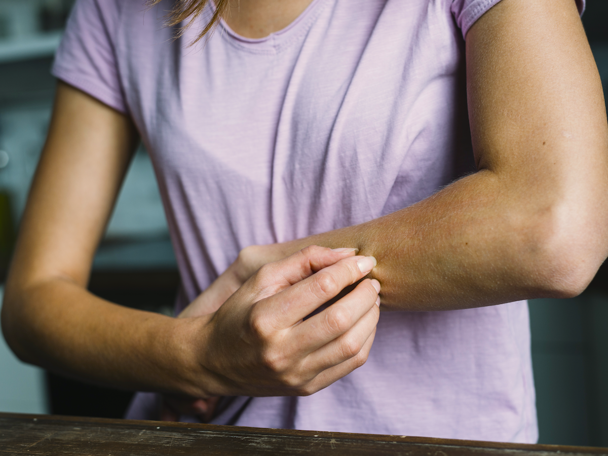 Measurement of Quality of Life in Patients with Mycosis Fungoides/Sézary Syndrome Cutaneous T-Cell Lymphoma: Development of an Electronic Instrument Measurement of Quality of Life in Patients with Mycosis Fungoides/Sézary Syndrome Cutaneous T-Cell Lymphoma: Development of an Electronic Instrument