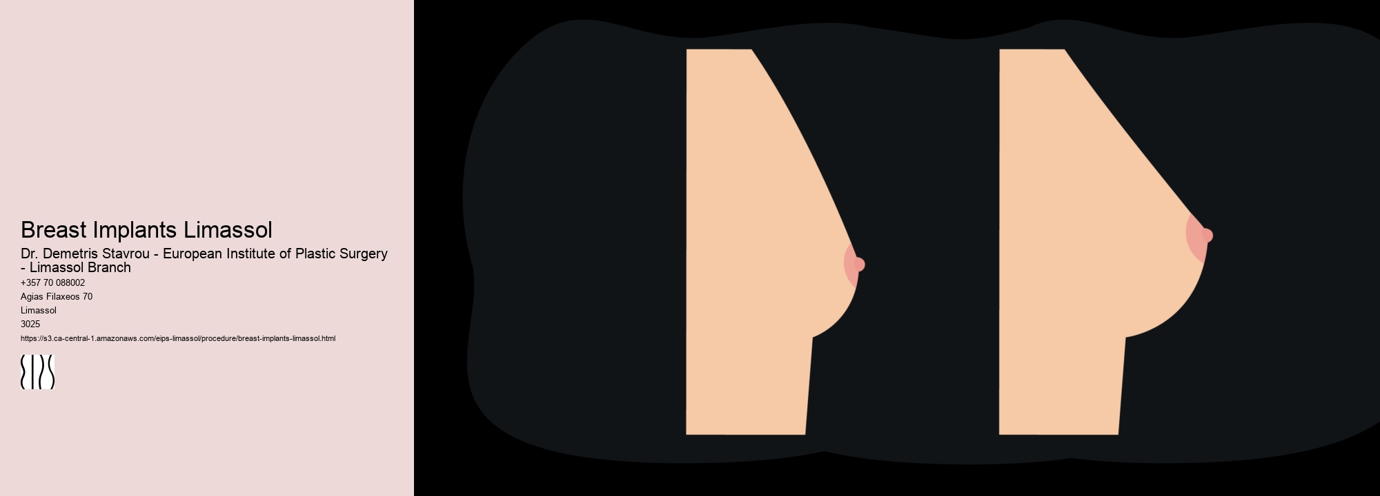 Breast Implants Limassol