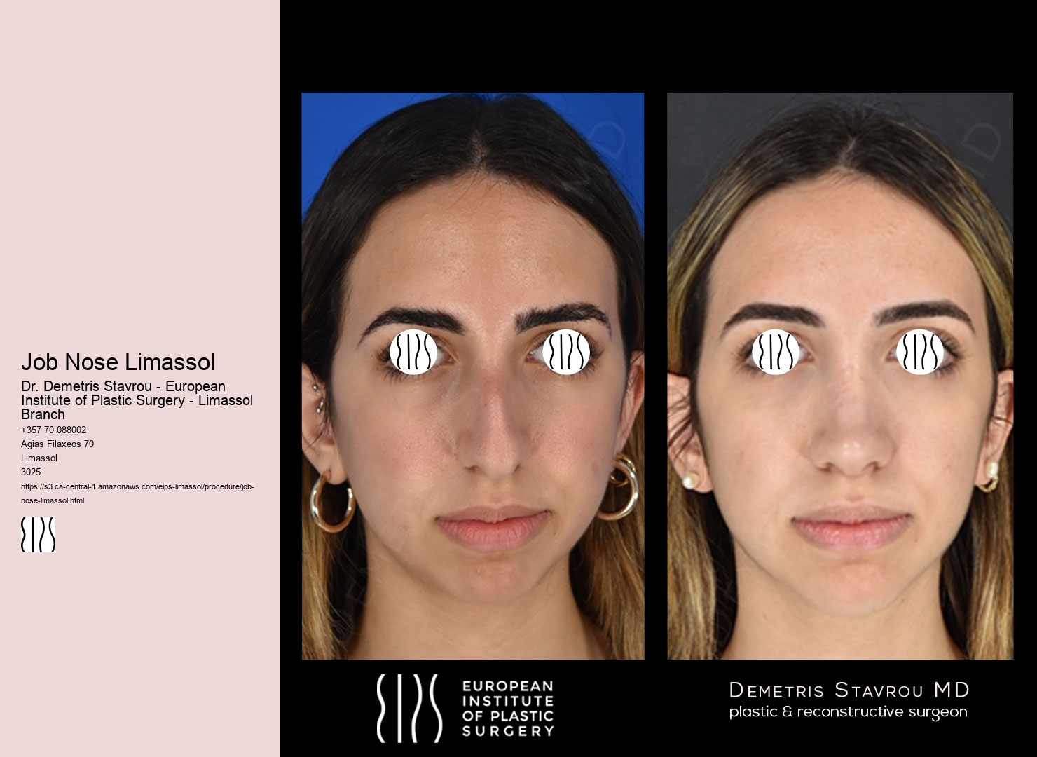 Job Nose Limassol
