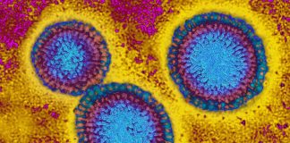 آنفولانزا چگونه باعث مرگ میشود