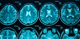 تفاوت سی تی اسکن با ام آر آی چیست؟