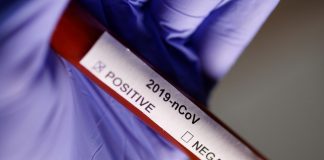 تایید 6 مورد جدید ابتلا به کروناویروس در بریتیشکلمبیا