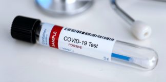 مرکز تشخیص جدید کووید19 در ونکوور باز شد covid-19-coronavirus1 (1)
