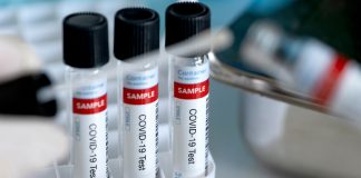 ابزار جدیدی برای ردیابی ویروس کرونا در کانادا covid-testing