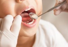 ۶۵۰ دلار کمک هزینه دور دوم مزایای دندانپزشکی برای کودکان زیر ۱۲ سال