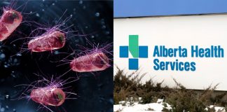 شیوع باکتری E.coli در مراکز مراقبت روزانه کلگری