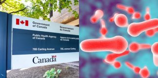 بررسی شیوع مشکوک بوتولیسم توسط آژانس بهداشت عمومی کانادا