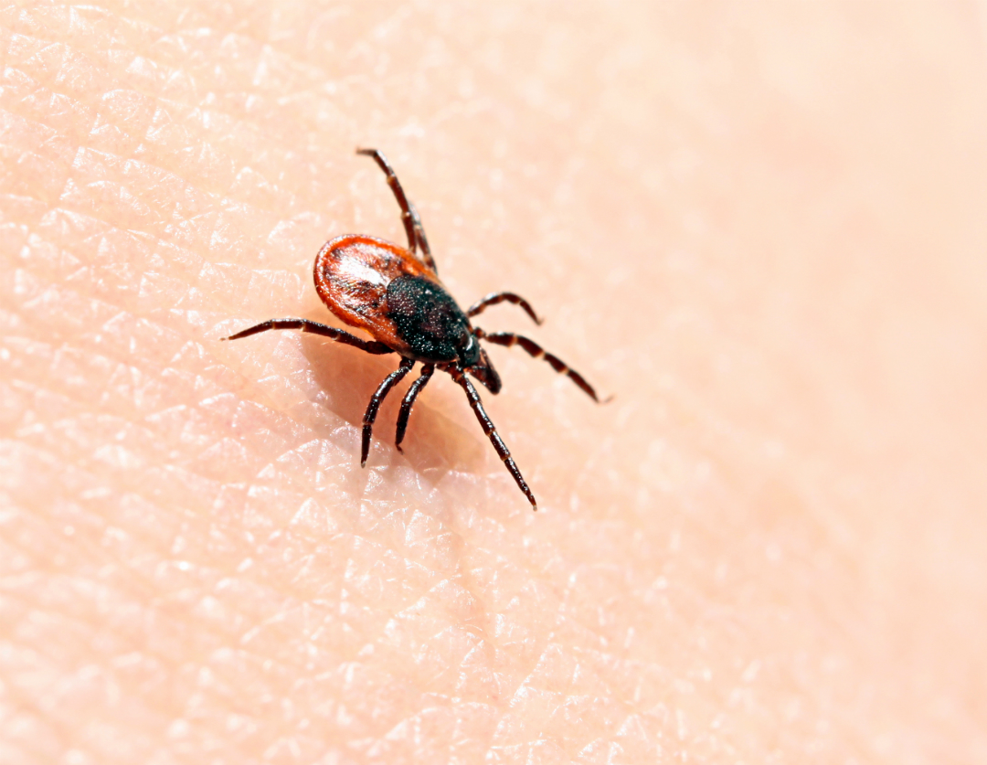 La maladie de Lyme plus présente que jamais en Montérégie