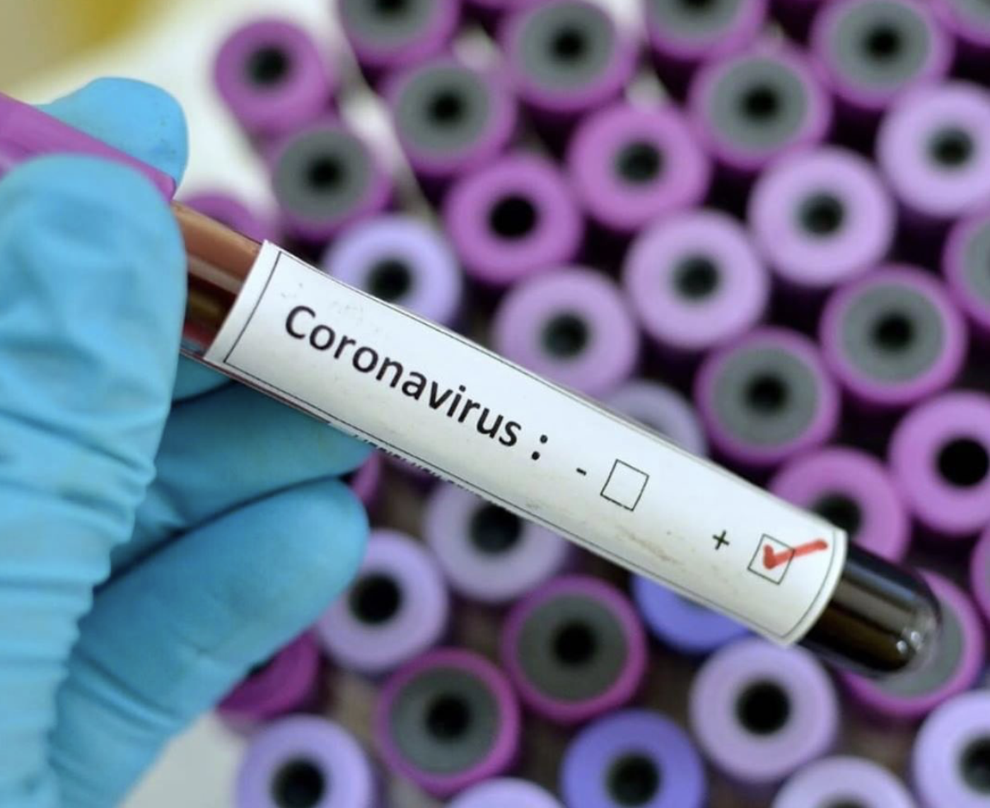 Hausse des cas actifs dans la MRC de Roussillon, des décès s&rsquo;ajoutent