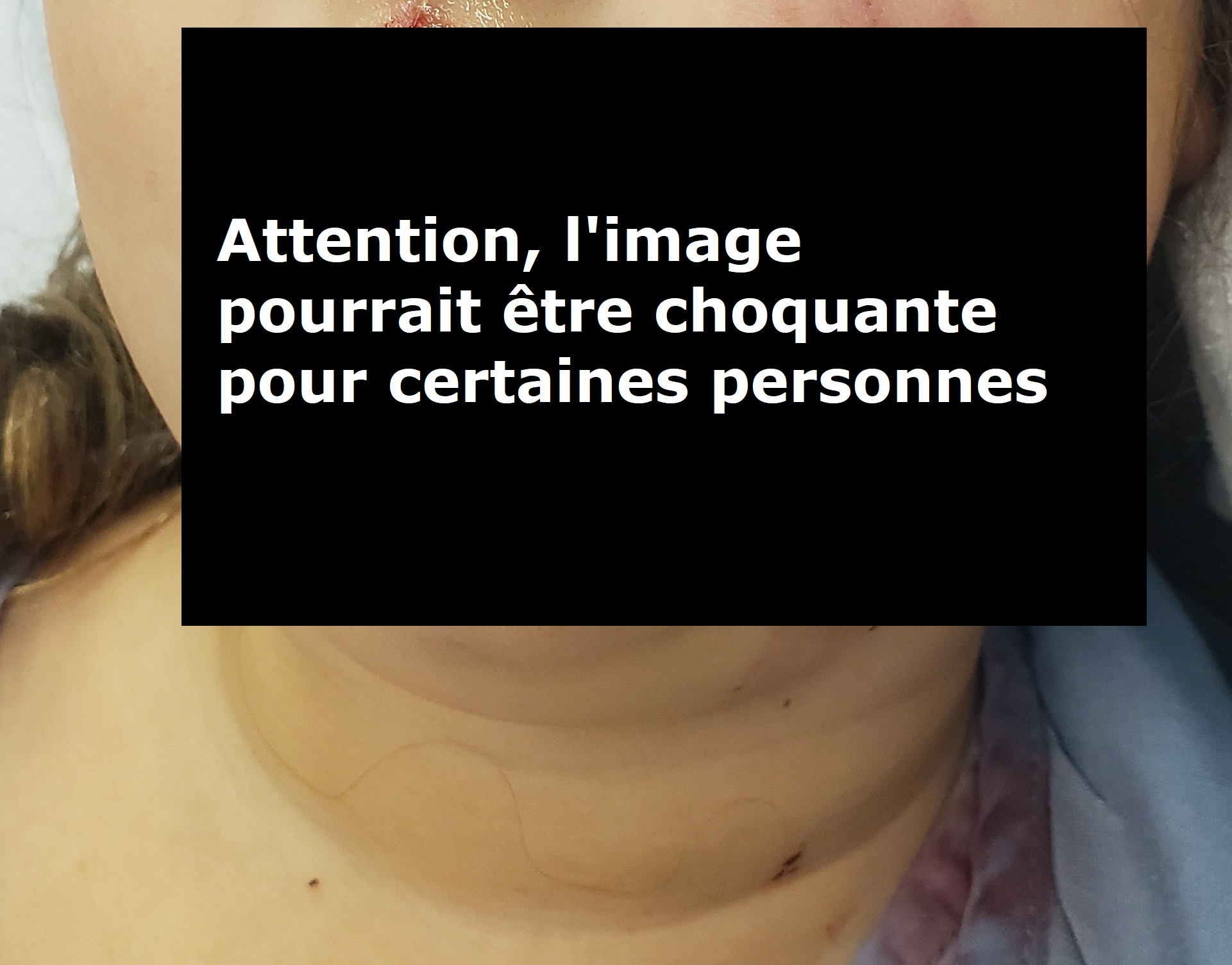 Un teckel euthanasié après avoir attaqué une fillette au visage