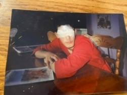 Blessé par l’éclipse en 1994, il met en garde les citoyens