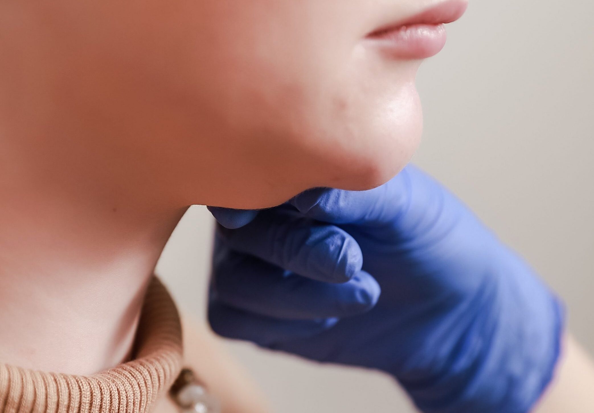 CoolSculpting journey