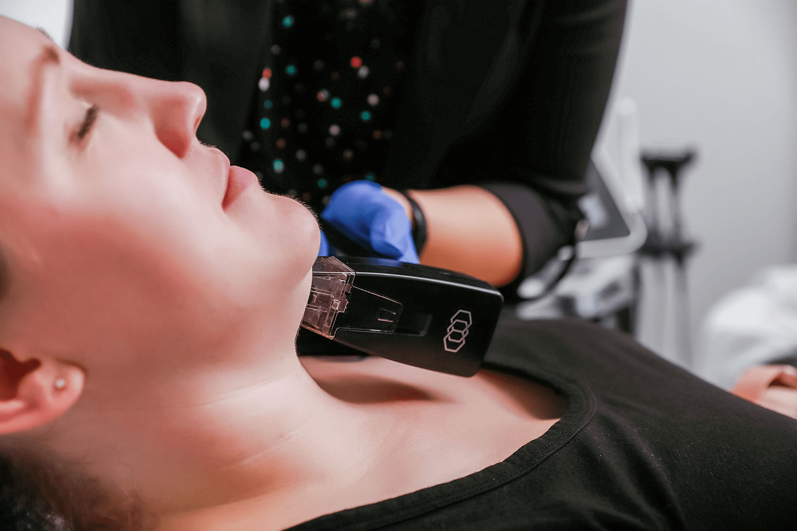 ageless-living-coldlake-morpheus8-explained (1)