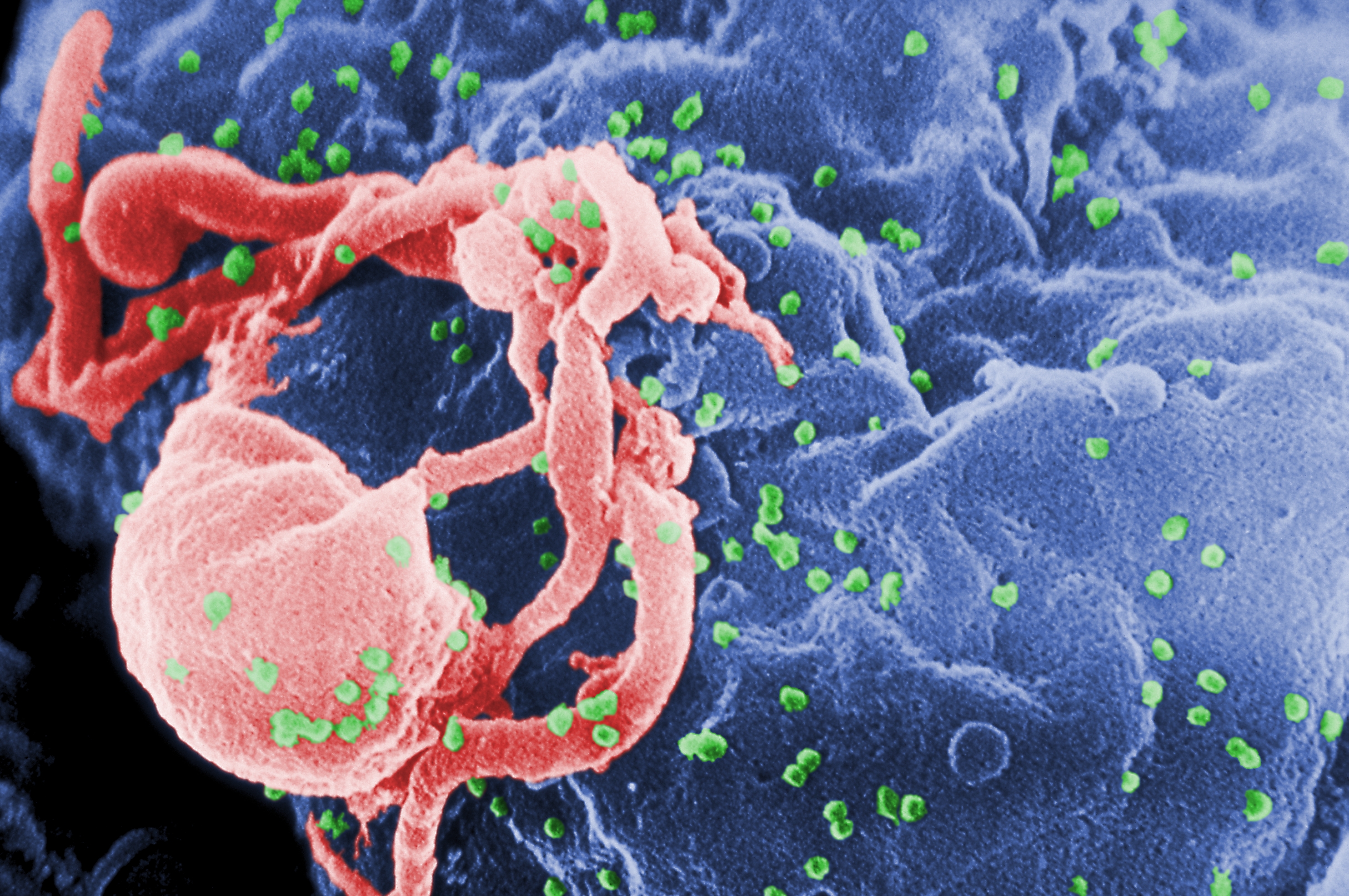 An HIV vaccine may be within reach