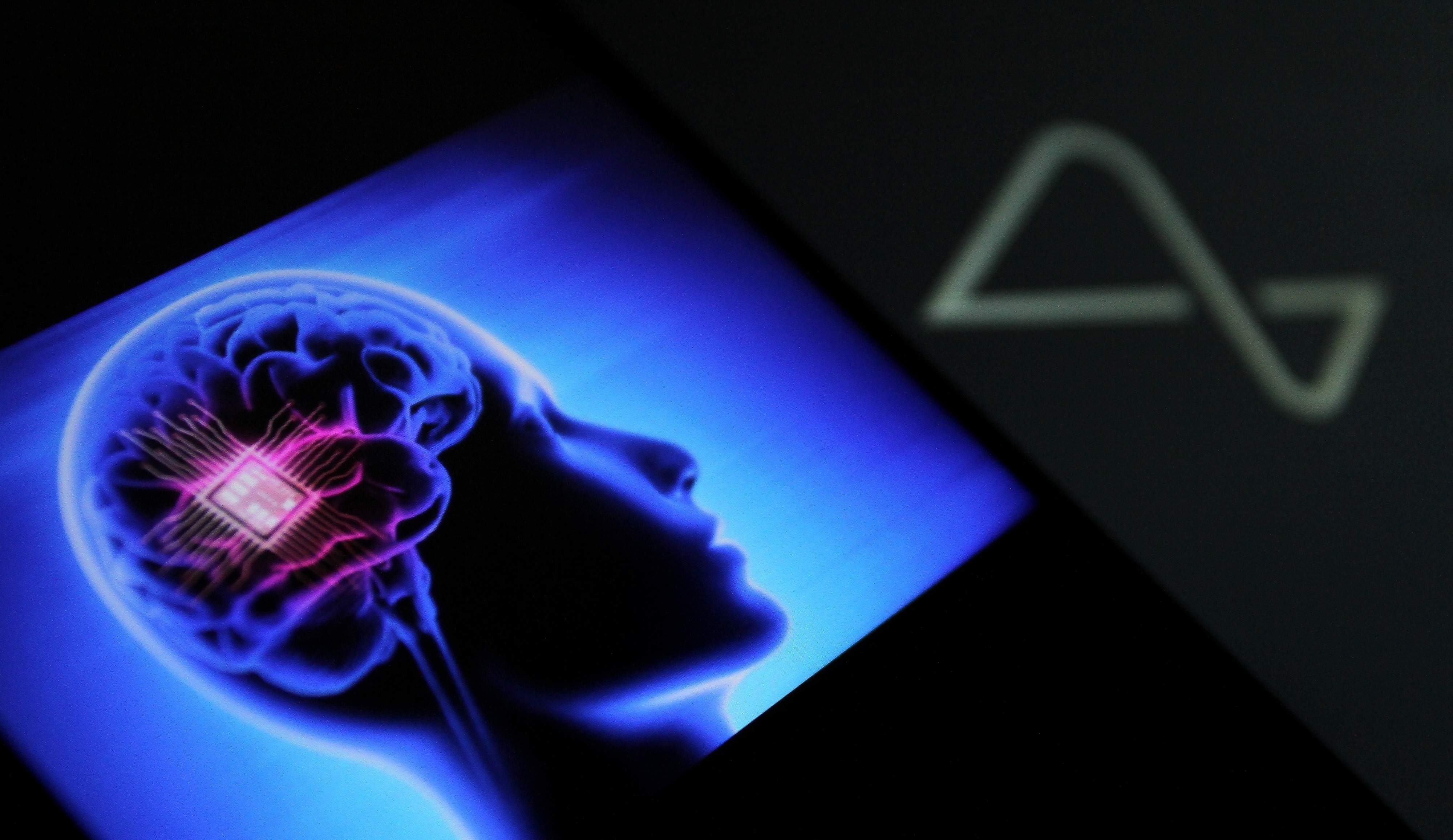 Neuralink comes to Canada