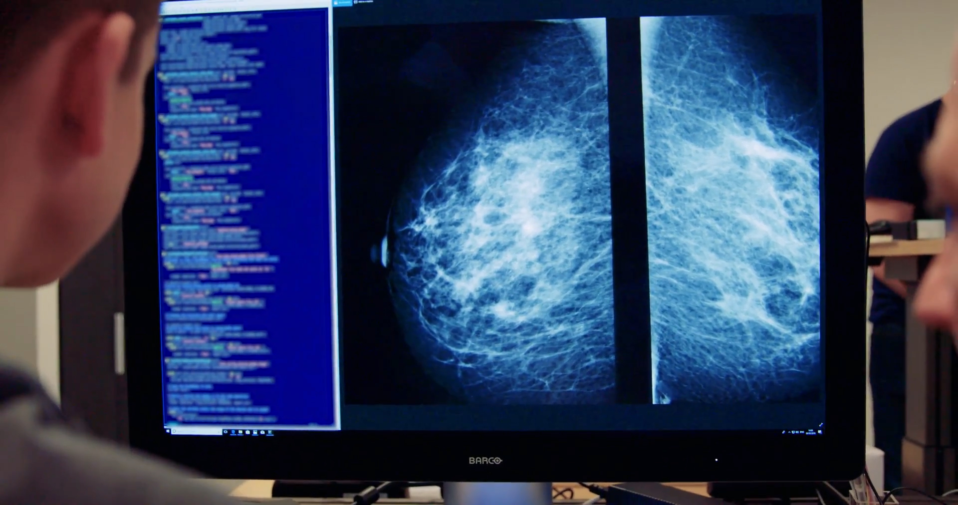 AI finds cancers that doctors missed
