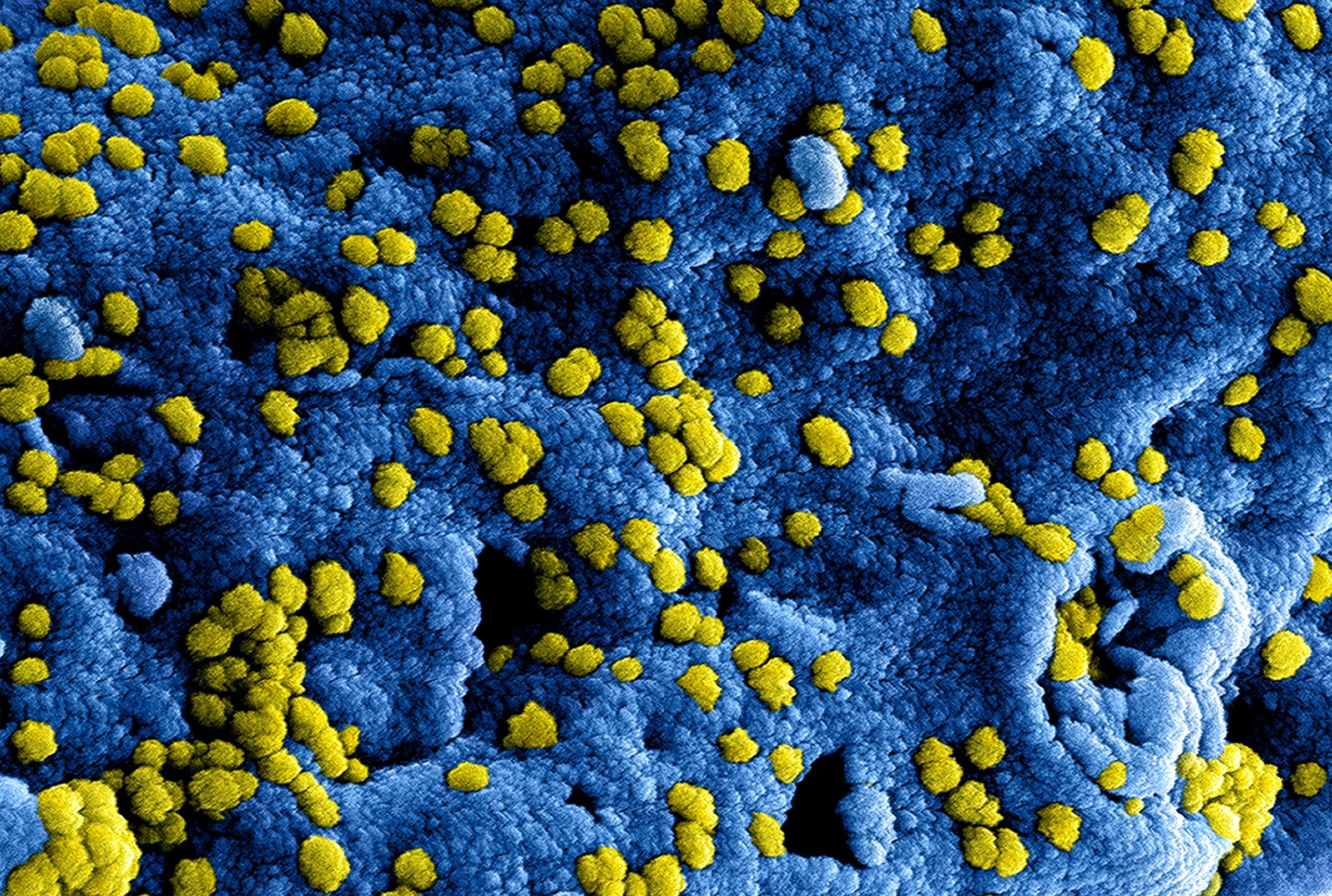 Recruiting viruses to cut carbon emissions