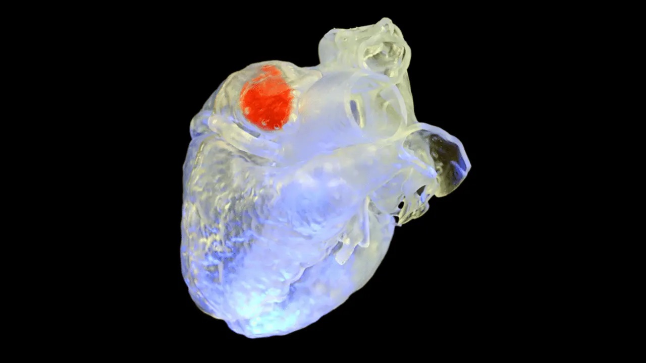 Skipping surgery by 3D printing bones and heart tissue