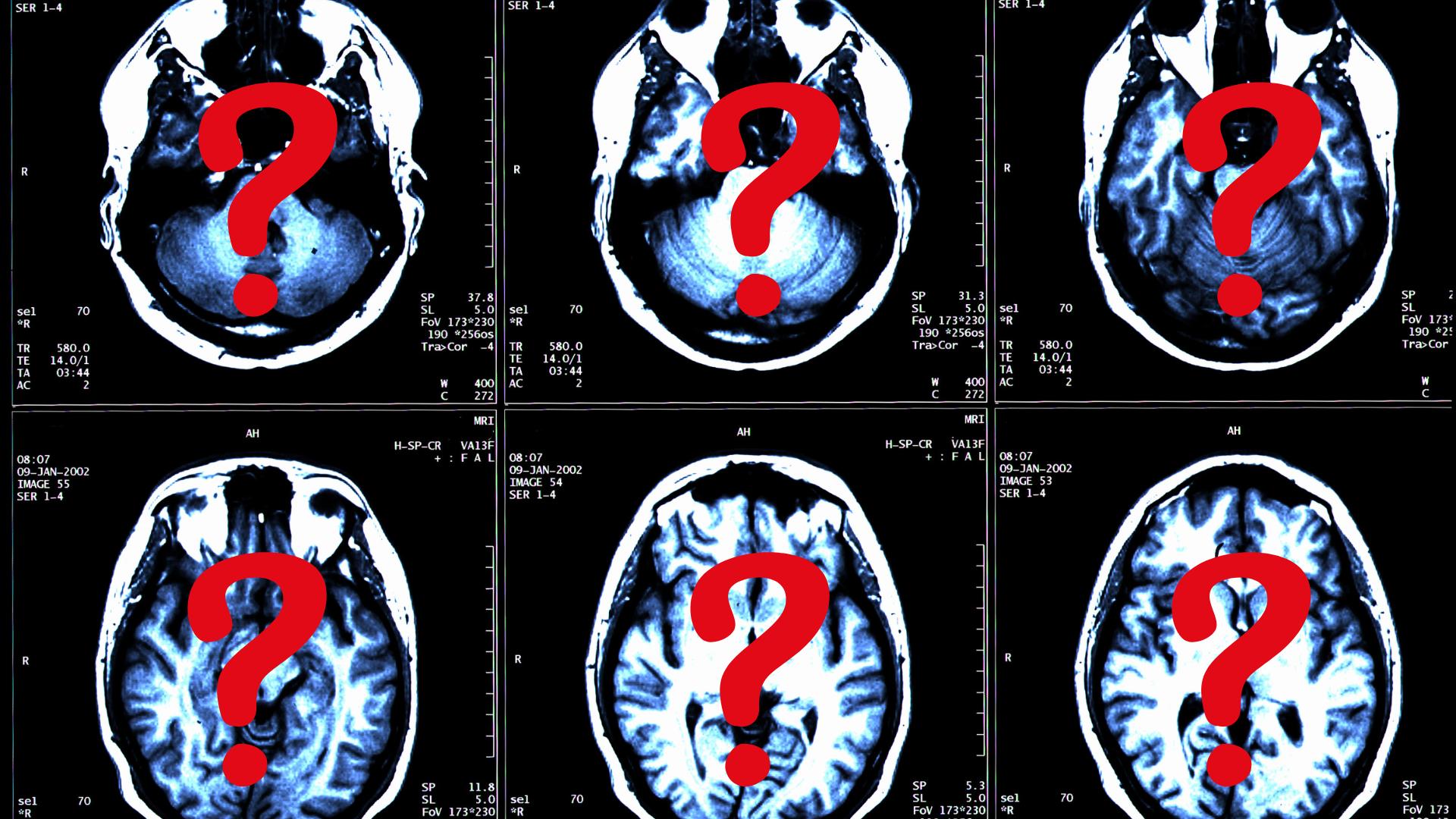 What’s the deal with New Brunswick’s mysterious illness?