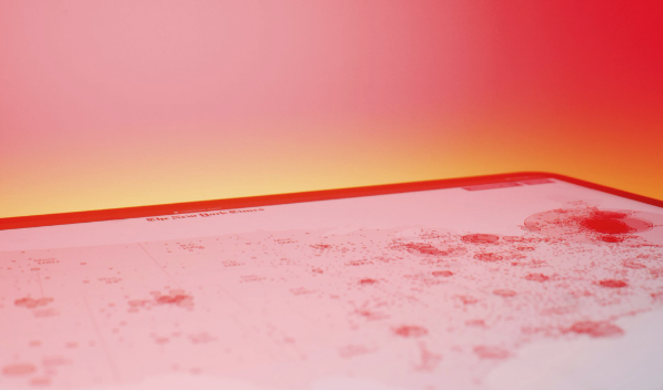 Canada’s got a measles problem